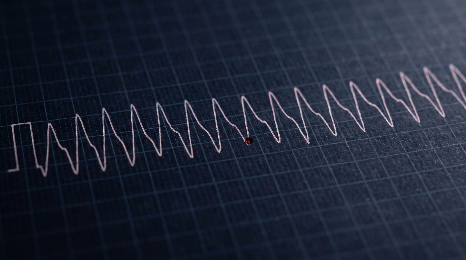 Tira de ECG em papel milimetrado escuro com complexos largos e regulares